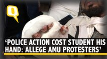 ‘Shell Exploded in My Hand’: Injured AMU Students on Police Action