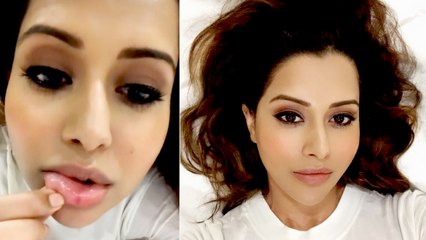 Bigg Boss நடிகை  Raiza விற்கு உதட்டில் காயம்