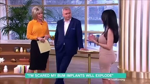 Cirugía estética: Esta mujer se hace implantes de glúteos y ahora no se puede sentar