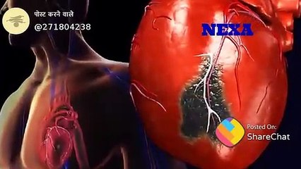 हार्ट अटैक से कैसे बचें  ll @ share it.. Sehat  like Jankari