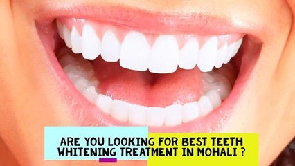 Best Teeth Whitening  Treatment in Mohali