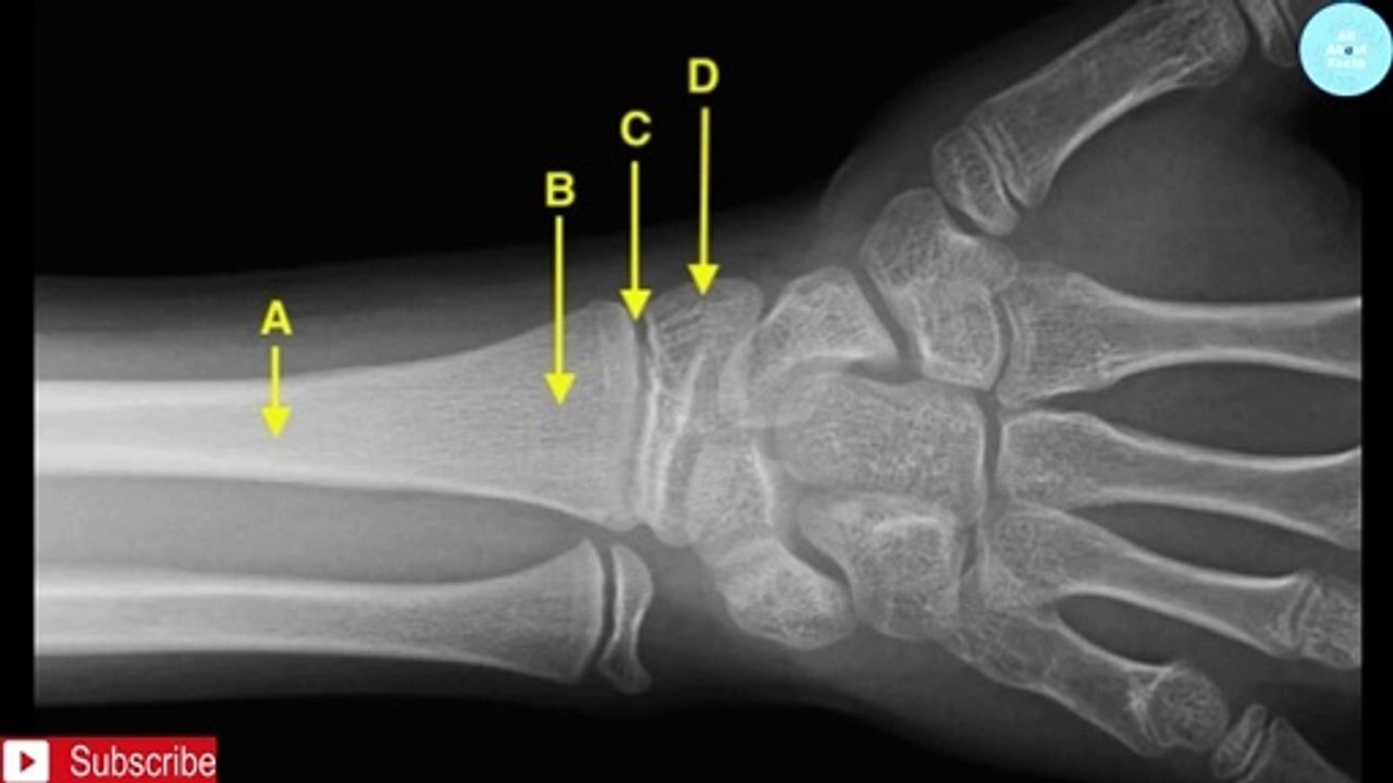 क्या_आपकी_हाईट_नहीं_बढ़_रही_हे_एक_बार_ये_चेक_करवा_लीजये | Facts about Height increase |Increase Height | All About Facts