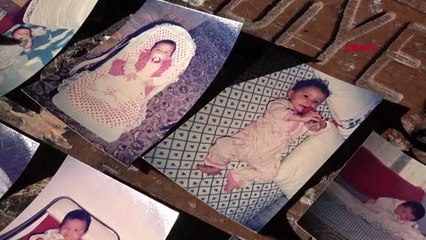Doğum lekesiyle 27 yıldır ailesini arayan dilek'e 4 baba adayı - arşiv