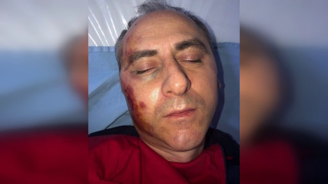 Trajkovski është rrahur, shtyhet edhe një herë seanca për rastin “TNT”