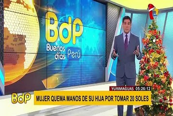 Yurimaguas: mujer quema manos de su hija por tomar dinero