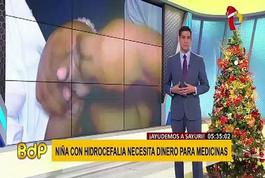Niña con hidrocefalia necesita ayuda para comprar medicinas para su tratamiento