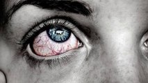 [आंखों में दर्द] के कारण, लक्षण और घरेलू इलाज - [eye pain] treatment in hindi - aankh mein dard hona