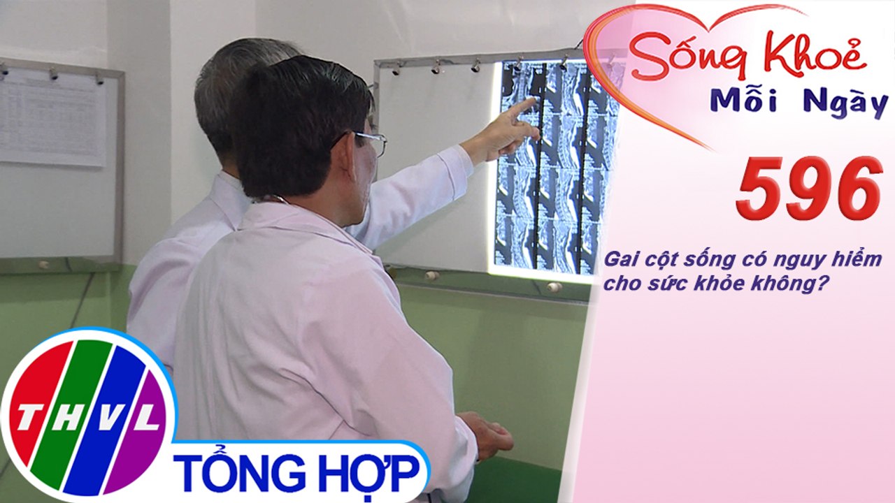 Gai cột sống có nguy hiểm cho sức khỏe không? | Sống khỏe mỗi ngày - Kỳ 596