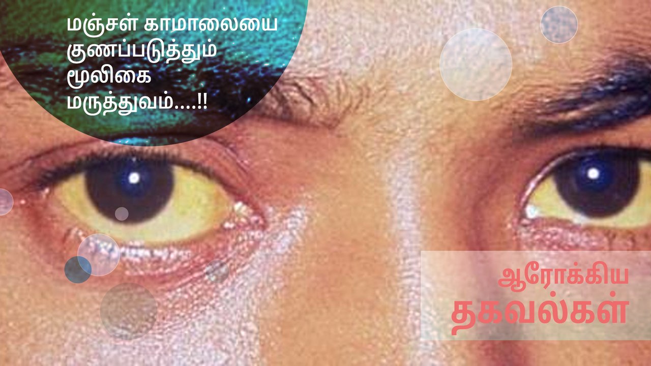 மஞ்சள் காமாலையை குணப்படுத்தும் மூலிகை மருத்துவம்....!!