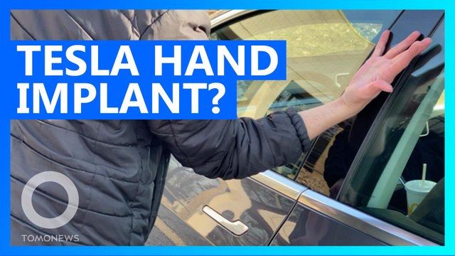 Utah bro implants Tesla key and other chips into his hands