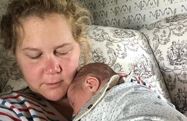 Amy Schumer's C-section took 3 hours