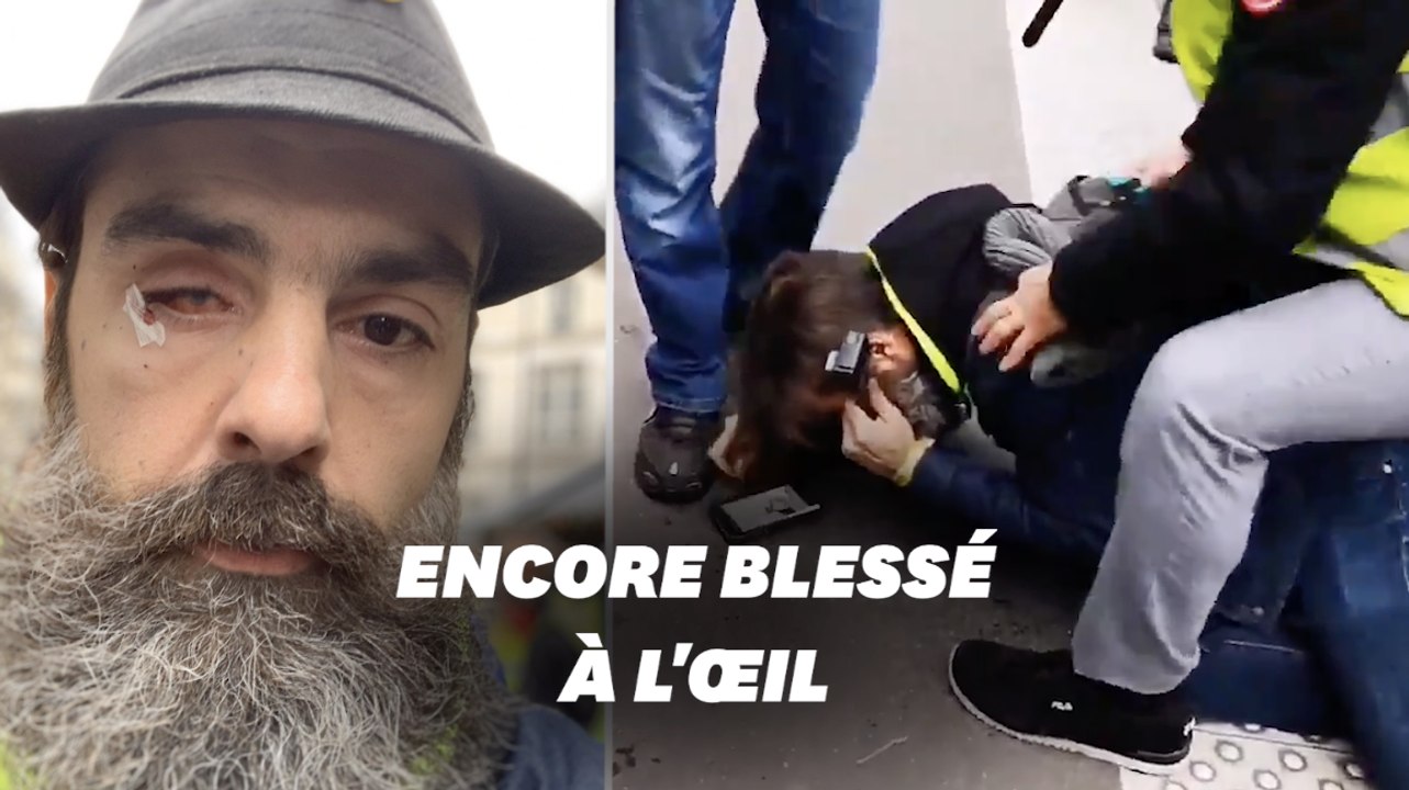 Jérôme Rodrigues blessé à l'œil pendant l'acte 59 des gilets jaunes