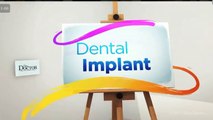 Natoli Dental - Dental Implants Why They Work - Natoli Dental: JOSEPH N. NATOLI, DMD