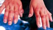 ठंड से हाथ - पैरों की उंगलीयों में सूजन और खुजली का घरेलू इलाज  Home remedies for chilblains | amazing tips for the swelling of fingers winter season in hindi | feet and hand swelling in winters | Health tips | Home remedies | chilbchilblains | घरेलू इलाज