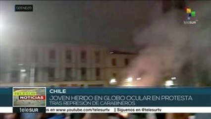 Joven chileno pierde un ojo por represión de carabineros