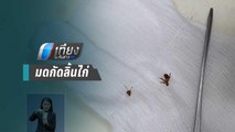 หมอ-คนไข้ งง คิดว่าก้างติดคอ ที่แท้มดกัดลิ้นไก่ | เที่ยงทันข่าว