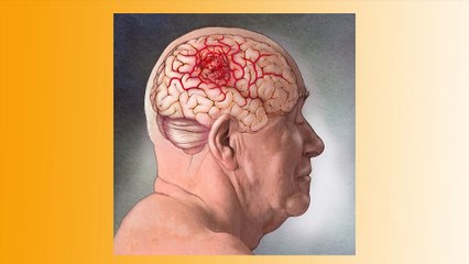 bd-salud-tumores-301219