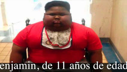 Este niño de 11años jamás en la vida pudo sentir el estómago lleno y murió