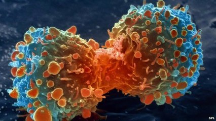En nuestra cocina utilizamos un condimento que mata a 7,5 millones de personas en todo el mundo