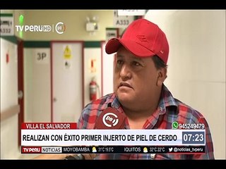 ¡Todo listo para el primer trasplante de piel de cerdo a un humano!