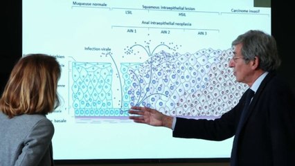 Santé - La vaccination au papillomavirus s'étend aux garçons