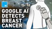 Study claims Google AI is more successful at breast cancer screenings than experts