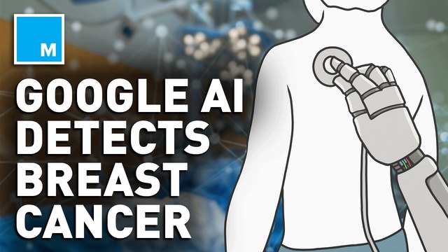 Study claims Google AI is more successful at breast cancer screenings than experts