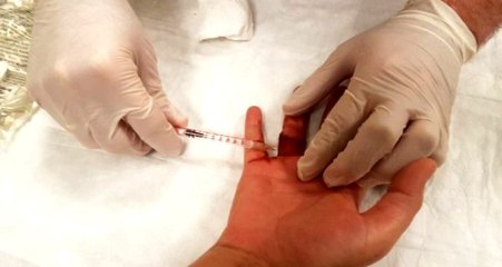 Evde temizlik yaparken düşen kadın neredeyse parmağından olacaktı