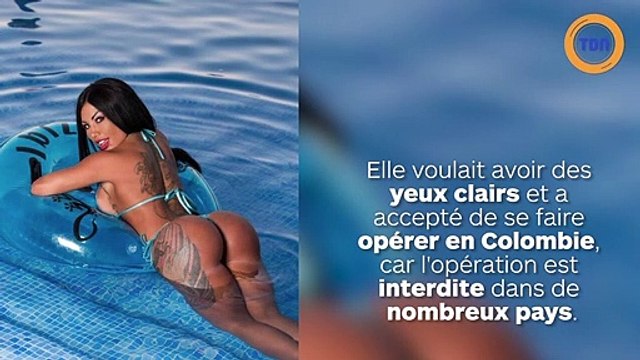 Influenceuse beauté sur Instagram et presque aveugle ! Son opération pour changer la couleur de ses yeux est ratée