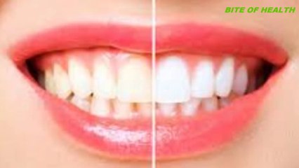 Teeth Whitening At Home In 3 Minutes || How To Whiten Your Yellow Teeth Naturally || 100% Effective