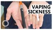 CDC links Vitamin E additives  to vaping related lung injuries