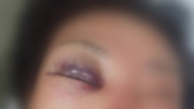 [단독] 술 취한 30대, 70대 노인 '묻지마 폭행'...경찰 수사 / YTN