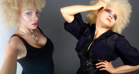 Çocukluğu boyunca görünüşüyle alay edildi! Büyüyünce gelen mankenlik teklifiyle hayatı değişti