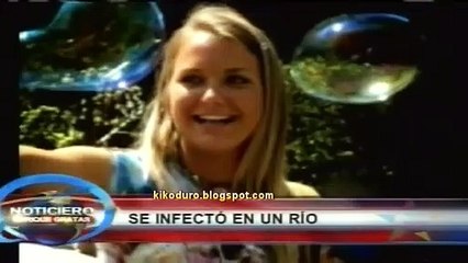 ¡Peligro! Arrestan a un hombre portador de una letal bacteria carnívora