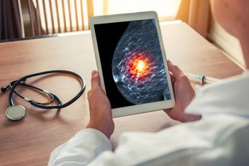 L'IA de Google détecte le cancer du sein avec plus de précision que les médecins