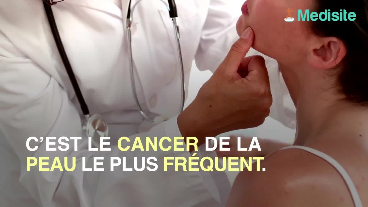 Sa cicatrice de varicelle devient un cancer de la peau…30 ans après !