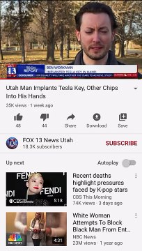 MAN IMPLANTS TELSA KEY IN HIS HAND