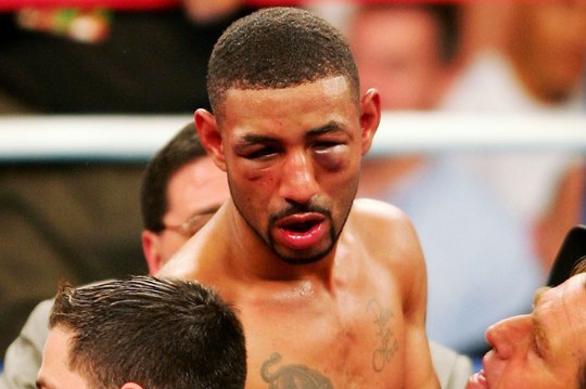 Diego 'Chico' Corrales: Increible lo que hacía este boxeador