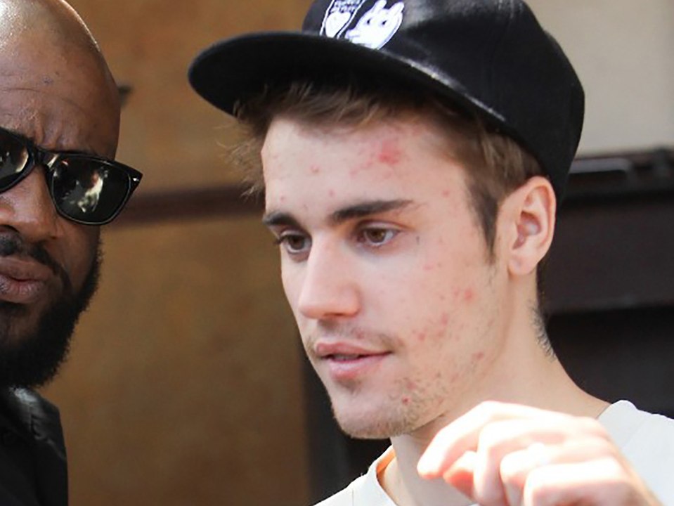 'Unheilbare' Krankheit: Justin Bieber leidet an Lyme-Borreliose