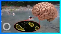 Pria terinfeksi amoeba pemakan otak setelah mandi di onsen - TomoNews