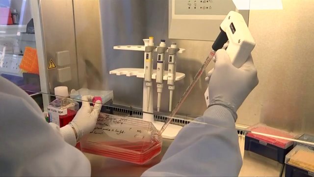 Inteligjenca artificiale kapërcen mjekët në diagnostikimin e kancerit të gjirit