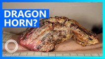 Brit man gets 5-inch dragon horn removed from back