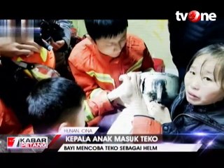 Kepala Balita Terjebak di Dalam Teko