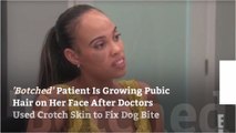‘Botched’ Patient Is Growing Pubic Hair on Her Face After Doctors Used Crotch Skin to Fix Dog Bite