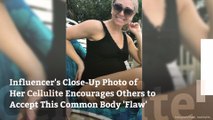 Influencer’s Close-Up Photo of Her Cellulite Encourages Others to Accept This Common Body ‘Flaw’
