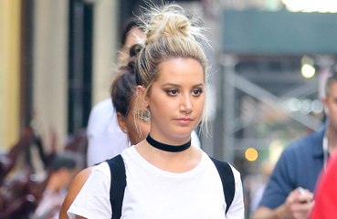 Ashley Tisdale slams pre-Botox