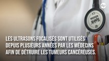 Ces ultrasons s'attaquent uniquement aux cellules cancéreuses et préservent les cellules saines