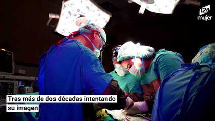 Sobreviviente de cáncer recupera parte de su rostro luego de perder su matrimonio