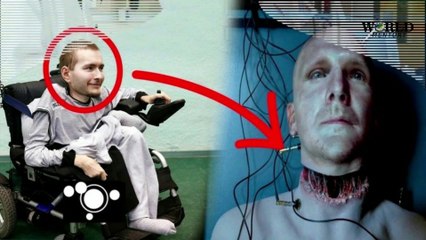 Human Head Transplant Surgery - Urdu/Hindi