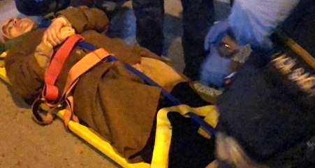 Otomobilin çarptığı kadın kısa süreli hafıza kaybı yaşadı! Sorduğu sorular şaşırttı